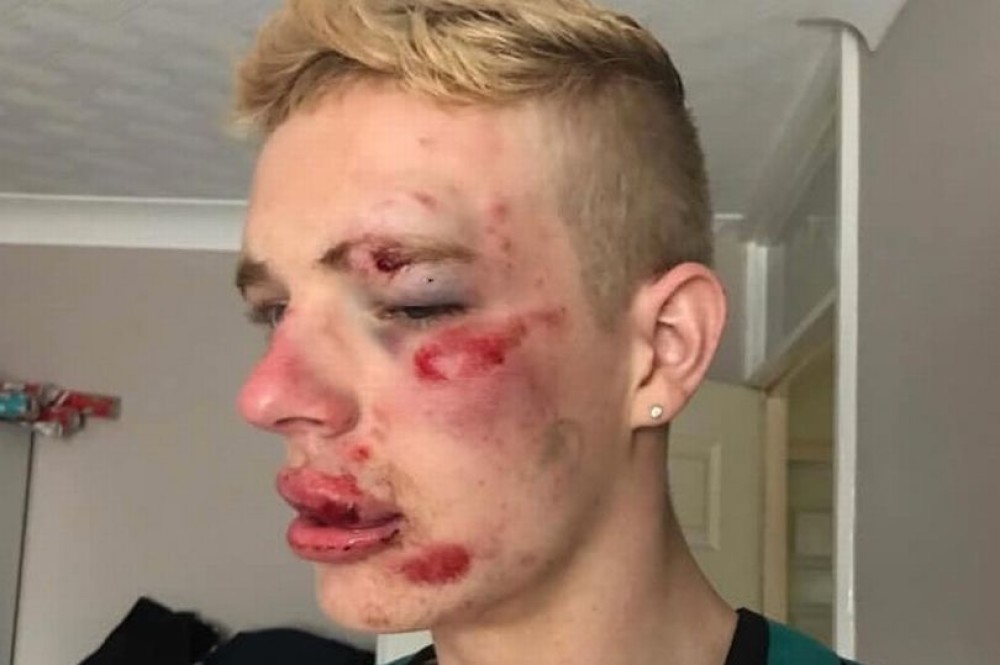 Ryan Williams - Homophobic-attack main.jpg